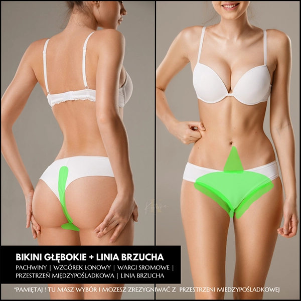 Epilacja laserowa bikini głębokie + linia brzucha