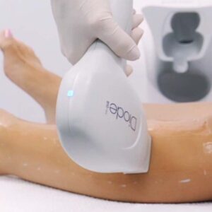 Epilacja laserowa baki