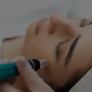 Mezoterapia mikroigłowa podstawowa
