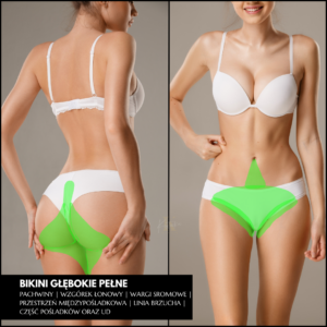 Epilacja laserowa bikini pełne